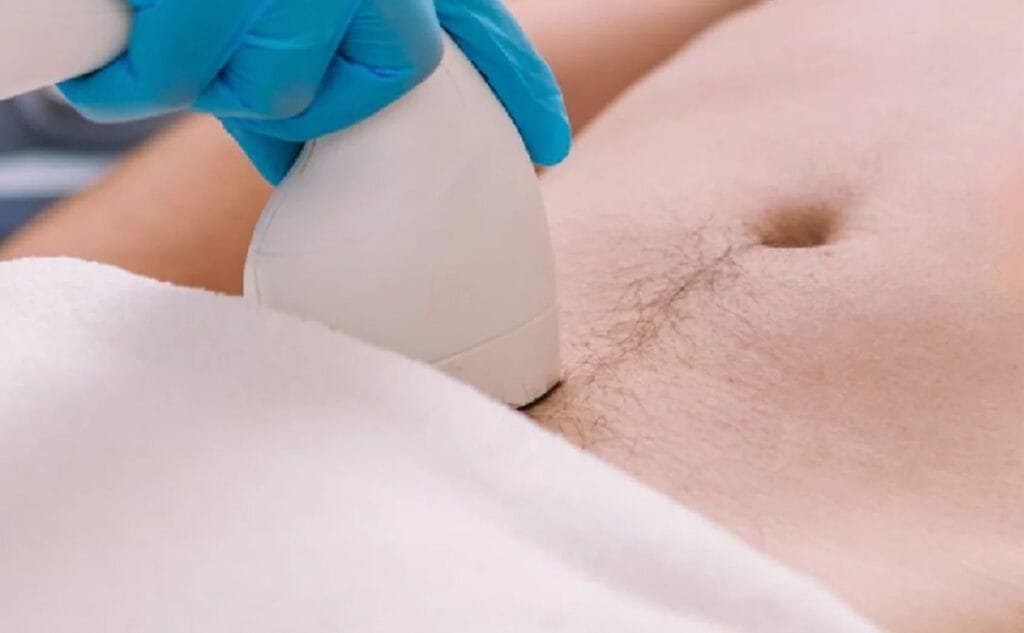 erkek-genital-lazer-epilasyon-hakkinda-merak-edilenler